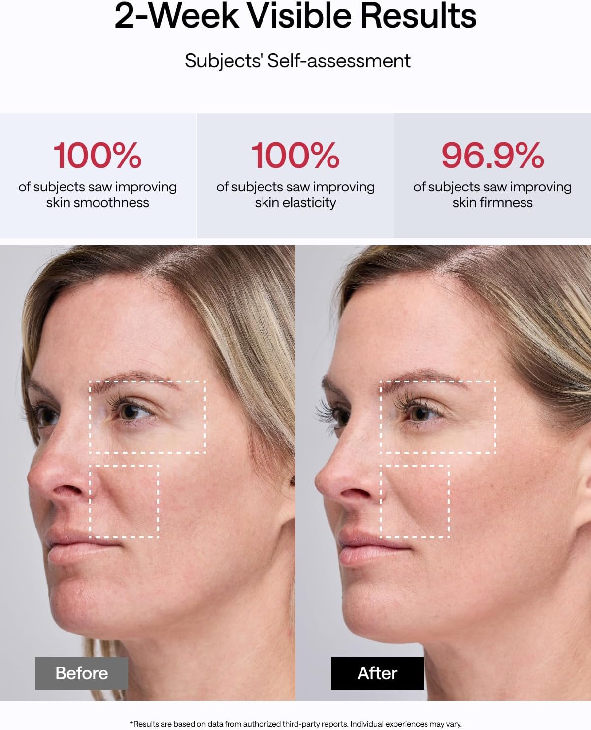 JMOON NouvelleSkin Facial Toning Device, FDA-Cleared Microcurrent Facial Device and Red Light Therapy for Face, 4 Modes & 5 Intensity Levels for Personalized Face Lift & Smoothing. M30U PR