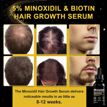 5% Minoxidil Hair Growth Serum, Topical Minoxidil for Men Beard Growth, Hair Regrowth for WomenTreatment for Scalp Hair Loss and Thinning, With Biotin