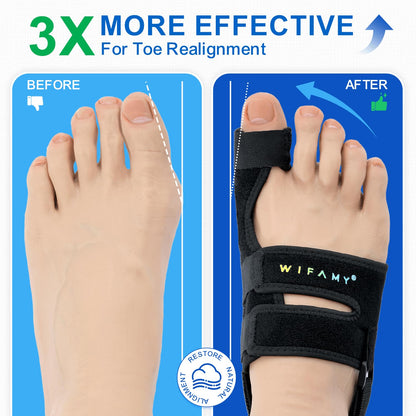 Bunion Corrector For Women Big Toe: Soft Gel Toe Separators For Women - Adjustable Straps & Breathable Design - Day/Night Pain Relief For High Heels & Flats