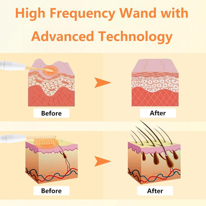 High F Rrequency Facial Wand for Face Care, Multi-Function Face Device Machine