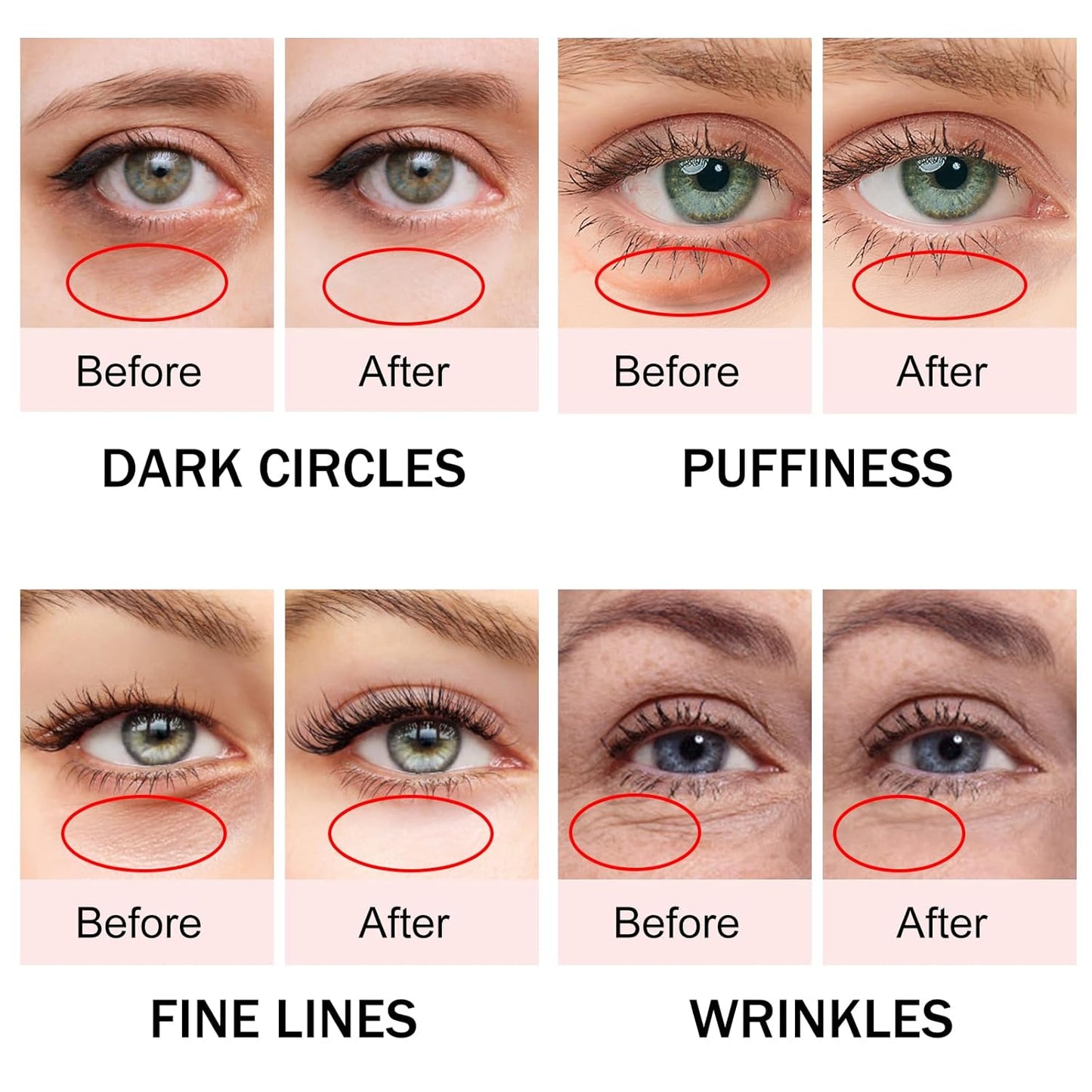 Caffeine Eye Cream,Dark Circles Under Eye Treatment For Puffiness And Bags Under Eyes Wrinkles Dark Circles w/Eye Serum & Eye Roller,Eye Cream Eye Care,Eye Bag Remover Puffy Eyes Treatment Products