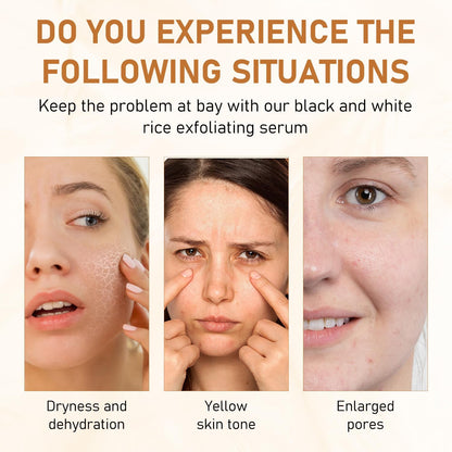 Rice Exfoliant Ampoule Duo, Black and White Face Peeling Solution, Moisturizing Pore Minimizer, 2-Pack, 100ml