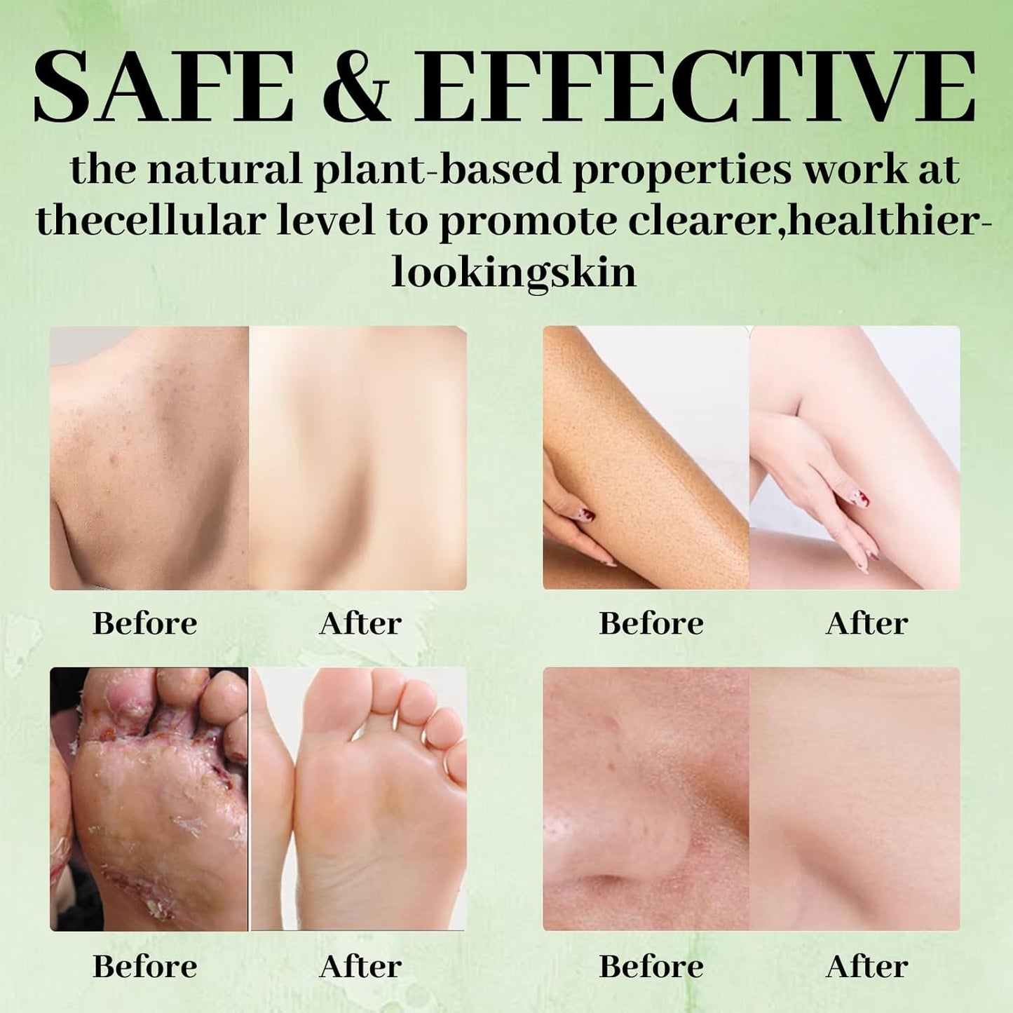 3PCS Tea Tree Soap, Tea Tree Relief Soap Bar, with Tea Tree Oil & Coconut Oil & Witch Hazel, Deep Pore Cleansing, Natural Herbal Foot Soaps Bar for Men & Women – 3.5 oz