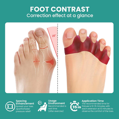 Welnove Toe Separator Bunion Corrector - 8 Pcs Gel Toe Straightener to Restore Hammertoes to Their Original Shape for Women Men, Toe Spacers for Gifts (Deep Red)