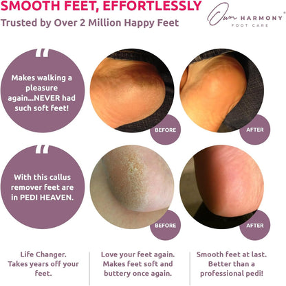 Electric Callus Remover for Feet: Professional Foot Care for Women by Own Harmony - Rechargeable Pedicure Tools - Electronic Foot File Pedi Sander - Best for Hard, Dry, Dead, Cracked Skin (3 Rollers)