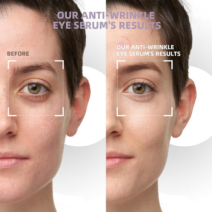 5% Caffeine Eye Cream & Under Eye Serum for Dark Circles and Puffiness Eye Care Eye Roller Serum with 360° Massage Ball Eye Treatment Serum Under Eye Roller Cream for Women Reduce Wrinkles Fine Lines