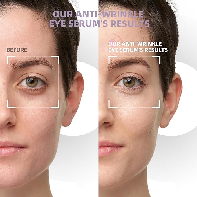 5% caffeine eye cream &