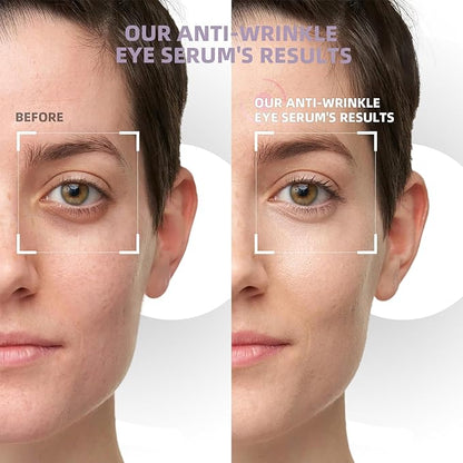 5% caffeine eye cream &