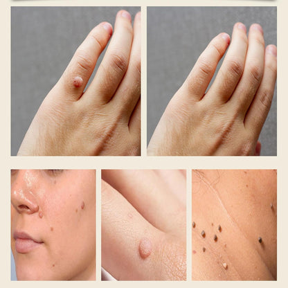 Bee Venom Skin Treatment Cream, Bee Venom Repair Cream, Suitable for All Skin Types