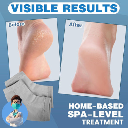 6 Pairs Moisturizing Heel Socks for Cracked Heel Treatment, Foot Care Toeless Socks to Soften and Hydrate Dry Cracked Feet Heels, Cracked Heel Repair Socks, Gel Socks for Dry Cracked Feet