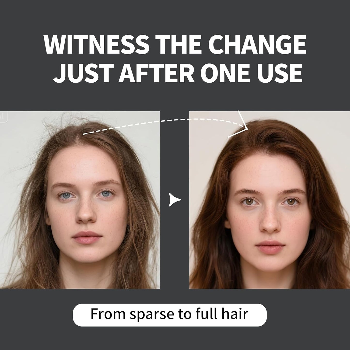 Hair Building Fibers Refill Pack - 100g Instant Thickening Fibers for Men & Women, Natural Cotton Powder, Wind/Rain Resistant, For All Hair Fiber Applicator Bottles (Dark brown)