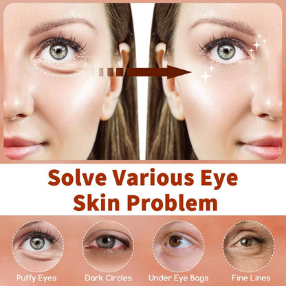 Caffeine Under Eye Masks, 60 Pcs Brightening Eye Patches for Dark Circles and Puffiness with Hyaluronic Acid, Reduce Dark Circles Eye Gel Pad