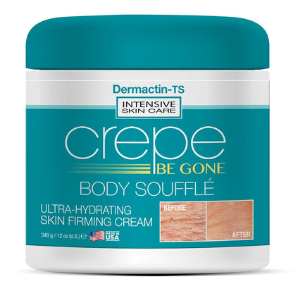 Crepe Be Gone Body Souffle Classic - Large 12 ounce - Ultra Hydrating Crepe Skin Firming Cream for Neck,Chest, Arms & Legs