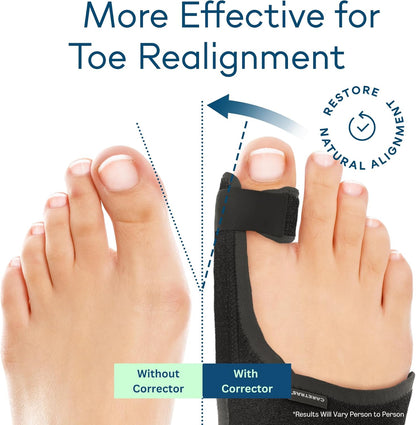 Caretras 2-Pack Bunion Corrector for Women & Men, Orthopedic Bunion Splint for Hallux Valgus Pain Relief, Big Toe Separator, Adjustable Day/Night Support, Comfortable Hammer Toe Straightener