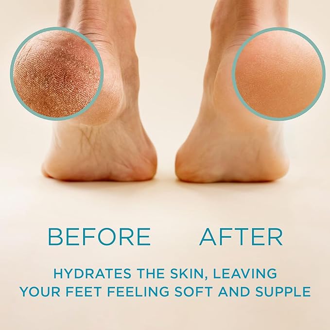 Lee Beauty Professional Callus Remover