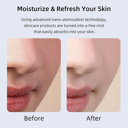 Microtree Nano Facial Steamer - Rechargeable & Portable High Pressure Face Oxygen Sprayer Machine, 0.3mm Nozzle Micro Mist Skin Hydrator, Essential Water Infusion Facial Spa Treatment, White