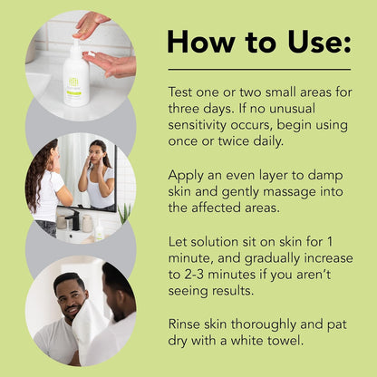 humane Benzoyl Peroxide Acne Body Wash - 10% Maximum-Strength Face, Skin, Butt, and Back Acne Treatment - 16 Fl Oz - Dermatologist-Tested Non-Foaming Acne Face Wash Cleanser - Vegan, Cruelty-Free