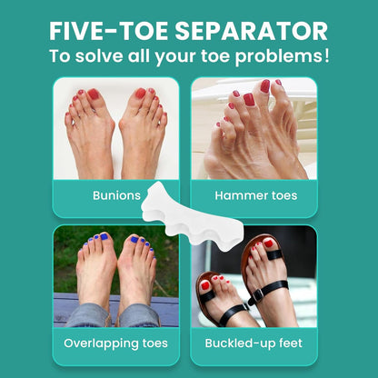 Welnove Toe Separators Spacers for Women - 8 Pack Gel Toe Straightener to Correct Bunions and Relieve Foot Pain - Silicone Toe Spacers for Hammertoe Yoga Practice - White