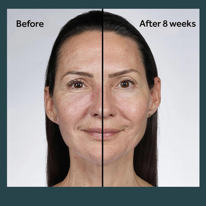 No7 Future Renew Damage Reversal Night Cream - Anti Aging Face Moisturizer - Infused with Peptide Technology to Reverse Visible Signs of Damage - Skin Barrier Repair for Dry Skin (1.69 Oz)