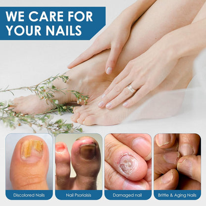 Toenail Repair Treatment, Extra Strength Nail Repair Liquid with Natural Tea Tree Oil Extract, Toenail Repair Solution for Thickened and Ingrow Nails