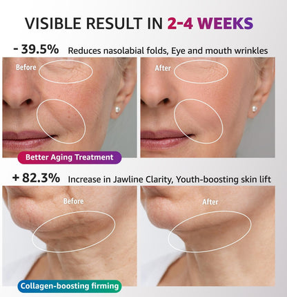 Red Light Therapy for Face and Neck, Renewal Face Lift Device with Vibration Tech, 3 in 1 Face Massager Tool with Thermals, True Beauty Glow Facial Sculptor for Wrinkles, Double Chin