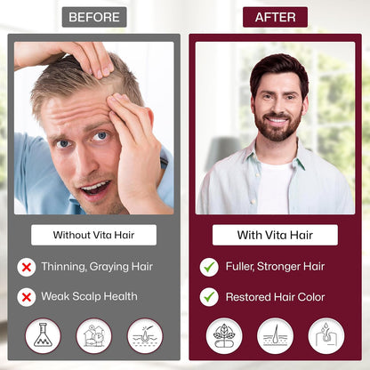 Vita Hair Growth & Hair Loss Supplement - 100% Natural Herbs Potent Formula for Graying Thinning Hair - Stimulate New Hair Follicles - 90 Capsules