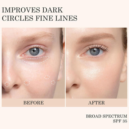 KYDA Mineral Sunscreen Eye Cream, 3-in-1 Anti-Aging Eye Cream, SPF 35, for Dark Circle and Fine Lines, Light