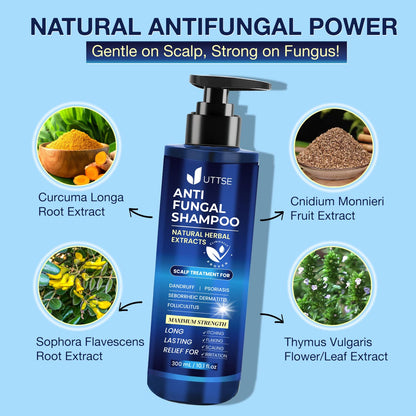 Anti-Fungal Shampoo for Scalp Psoriasis: Dandruff Shampoo for Folliculitis and Seborrheic Dermatitis - Relieves Itchy & Dry Scalp - 300 mL / 10.1 fl.oz