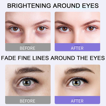 Under Eye Roller Cream For Dark Circles And Puffiness, Under Eye Cream With 360° Massage Ball Reduce Wrinkles, Dark Circle Eye Cream Tightens Under Eye Bags And Puffiness for Women