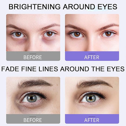 Under eye roller cream for