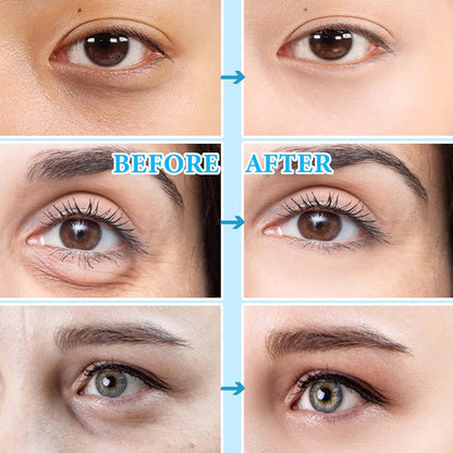 30 Pairs Gold Eye Mask,Under Eye Patches for Dark Circles and Puffiness,Hydrating and Moisturizing,Reduces Eye Bags and Smoothes Frownies,Eye Treatment Patches,Skin Care Products