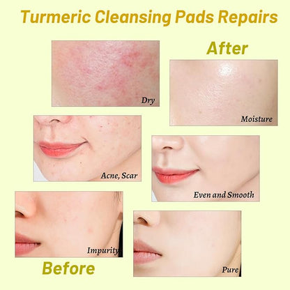 120 pads turmeric cleansing pads