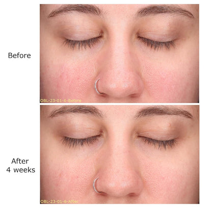 Decongest & Clarify System Collection, Activator with Clarity Facial & Azelaic Acid Concentrate, Skin Revitalizers, Care Routine, Suitable for Oily Skin, Gift Bundle / Starter Kit