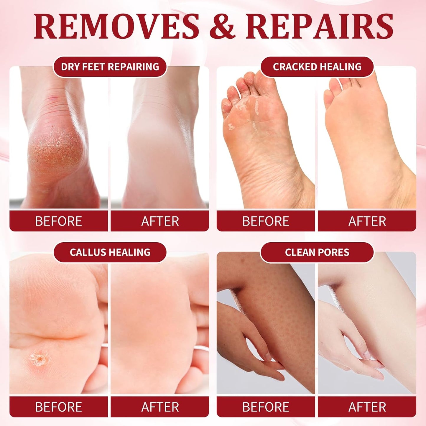 Pedicure Kit Foot Soak Set: Bubble Salt, Sugar Scrub, Massage Mask, Massage Lotion in a Box, 4 Step Foot Spa Kit for Dry Feet,Tired Feet (1 Set Pomegranate)