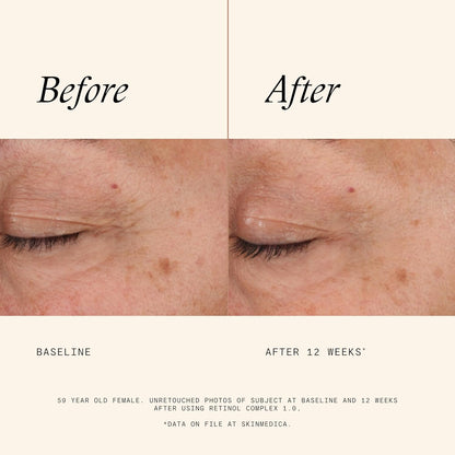 SkinMedica Retinol 1.0 Complex - Retinol Serum for Face, Age-Defying Advanced Retinol Cream That Renews Skin and Diminishes the Appearance of Fine Lines and Wrinkles, 1 Fl Oz