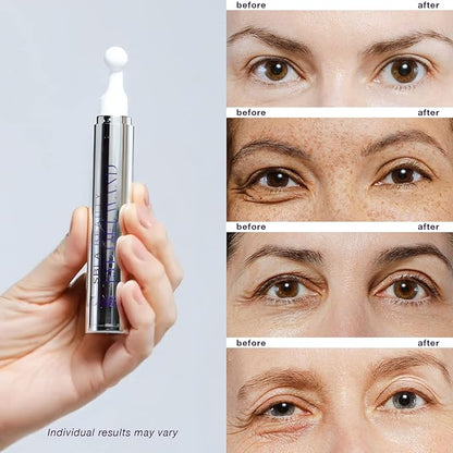 Sbla beauty - eye lift