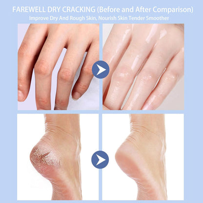 Crack Feet Prevention Stick 2PCS - Foot Care Cream Heel Balm for Dry Cracked Feet, Remove Dead Skin and Moisturize Dry Skin for Face, Knees, Elbows, Hands (2pcs, Orange + Banana)
