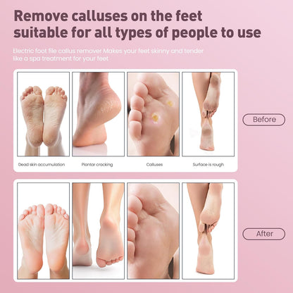 Electric Foot Callus Remover,2 in1 Rechargeable Callus Remover for Feet,9-Speed Cordless Electric Foot File Nail Grinder,Foot Scrubber Pedicure Tools for Dead Skin Dry Cracked Feet(Pink MINI)