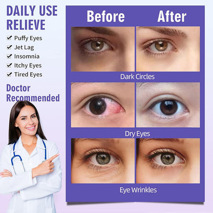 Serfeymi 10 Packs Steam Eye Mask Sleeping Mask for Women, Eye Beauty Heated Eye Mask, Hot Compress Disposable Promote Sleep Eye Mask for Puffy Eyes, Dry Eyes, Dark Circles, Tired Eyes (Lavender)