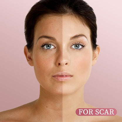 Yoken Rosehip Seed Oil For Face,100% Pure Rosehip oils For Skin,Scars,Hair & Nails.4 fl Oz Cold Pressed Rose Hips Oil For Skin Care, Anti-Aging, Scar Treatment, GUA SHA Massage DIY (4 Fl Oz)