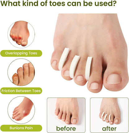 Bukihome 50 Pack Foam Toe Separators - Correct Overlapping Toes and Reduce Friction - Breathable and Comfortable, Foam Toe Spacers for Women
