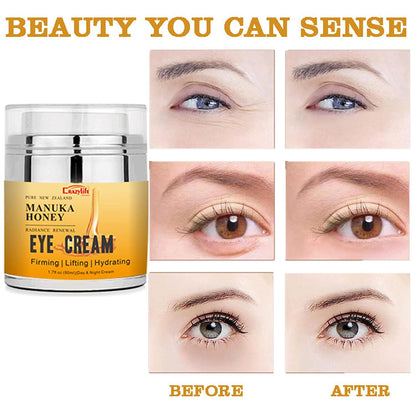 Manuka Honey Eye Cream for Dark Circles and Puffiness, Under Eye Cream, Anti Aging Eye Cream, Improve the look of Fine Lines and Wrinkles, Retinol and Aloe Vera Natural Relief