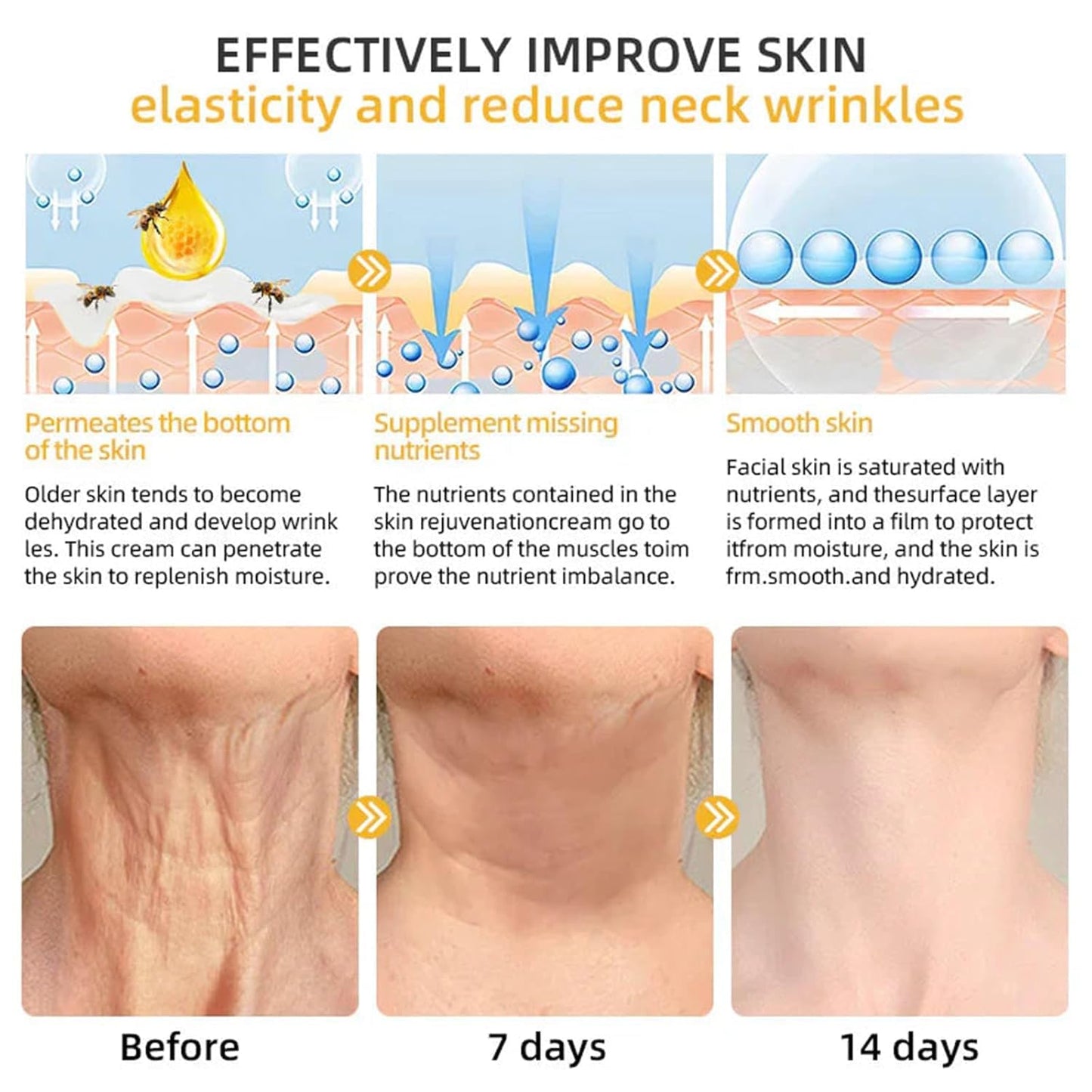 Bee Venom Comprehensive Bee Cream,2025 Professional Treatment Cream Wrinkle Removal Anti-Aging Moisturizing,Effective In Reducing Skin Blemishes (2PCS)
