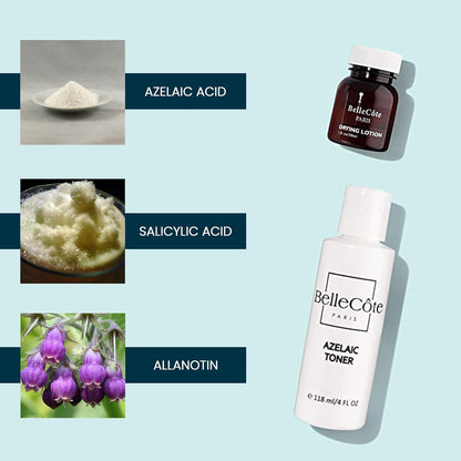 Azelaic Toner & Drying Lotion Duo - Face Treatment Set for Rosacea & Cystic Acne, Soothing Redness Relief, Shrinks Whiteheads & Pores | Normal to Oily Skin