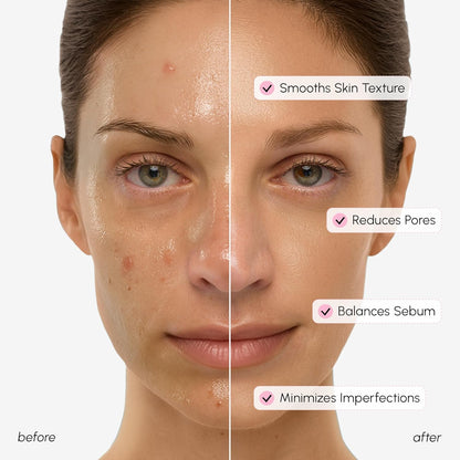 MAREE Pore Minimizer for Face Toner – Witch Hazel Toner with Niacinamide & Marine Collagen – Gentle Exfoliating Oil Control Facial Toner for Women – BHA Liquid Exfoliant – Alcohol Free Tonico Facial