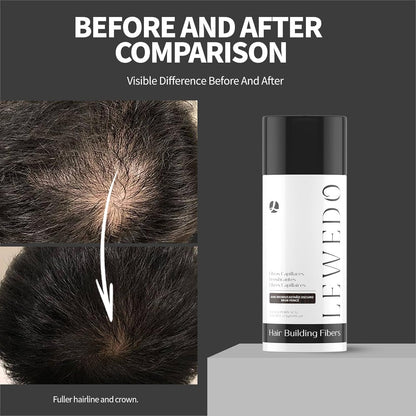 Hair Building Fibers 25G with Precision Spray Applicator - Electrostatic Adsorption for Instant Thicker Hair, Waterproof & Natural Look, Suitable for Men & Women (Medium brown)