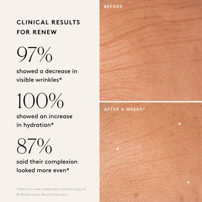 Naked & Thriving Wrinkle-Fighter Set, Includes Renew Resurfacing Night Serum (30 mL) & Illuminate C+ Serum (30 mL), Clinical Results, Dermatologist Loved, Hylauronic Acid & Bakuchiol (Set of 2)