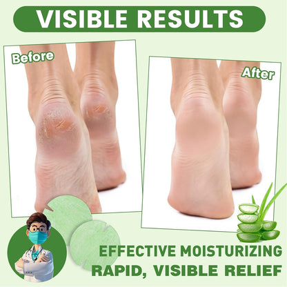 30PCS Patented Aloe Vera Cracked Heel Treatment Patches, Cracked Heel Repair Bandage