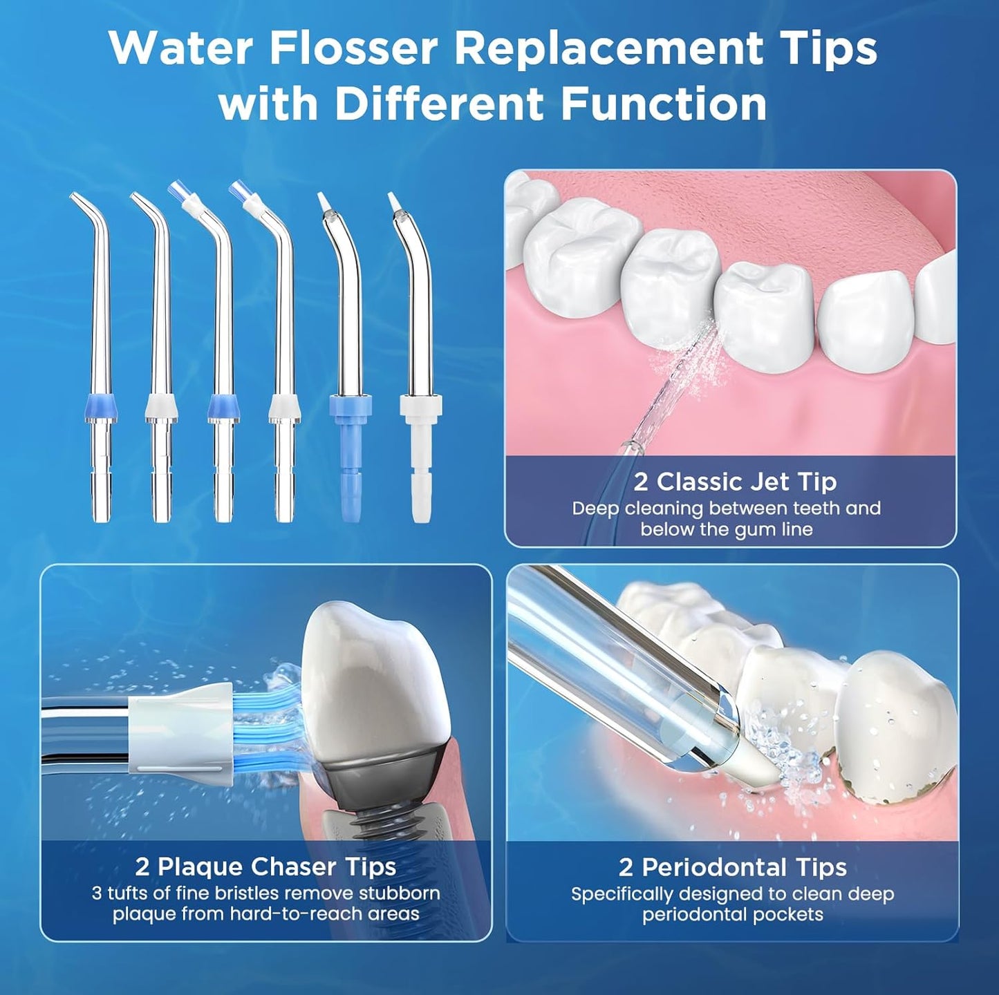 Replacement Tips for Waterpik, Water Flosser Replacement Heads Parts for Waterpik Oral Irrigator(2 Classic Jet Tips + 2 Plaque Chaser Tips + 2 Periodontal Tips + Storage Case Combo)