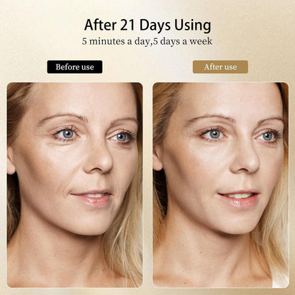 8 Modes&3 Color Facial-Massager-Device(Gold)